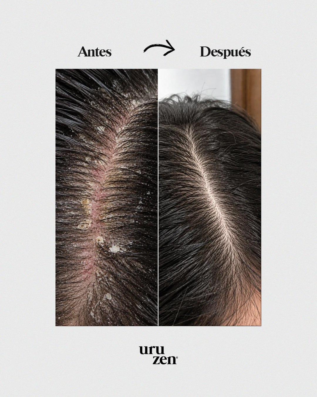 Tónico Natural Uruzen · Purifica y equilibra el microbioma capilar · Cuero cabelludo en paz
