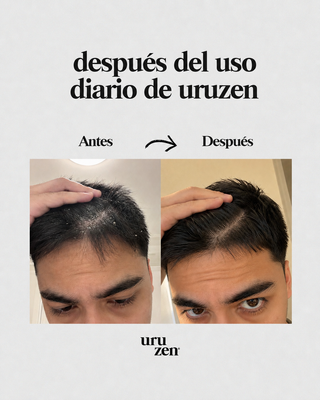 Tónico Natural Uruzen · Purifica y equilibra el microbioma capilar · Cuero cabelludo en paz