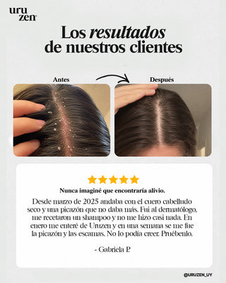 Tónico Natural Uruzen · Purifica y equilibra el microbioma capilar · Cuero cabelludo en paz