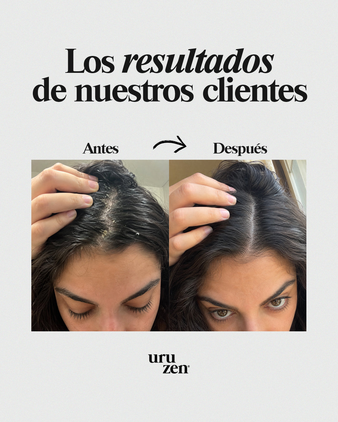Tónico Natural Uruzen · Purifica y equilibra el microbioma capilar · Cuero cabelludo en paz