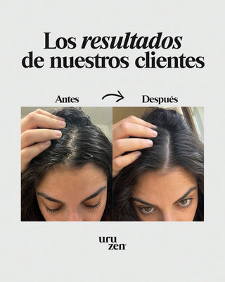 Tónico Natural Uruzen · Purifica y equilibra el microbioma capilar · Cuero cabelludo en paz